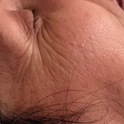 Anti-Aging und Glow – Ausgangssituation vor der Behandlung